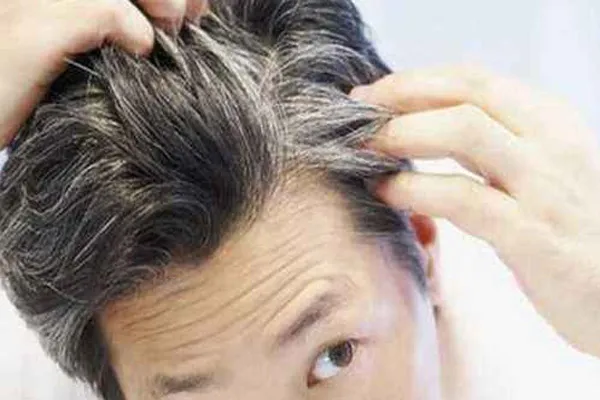 长了白头发是什么原因